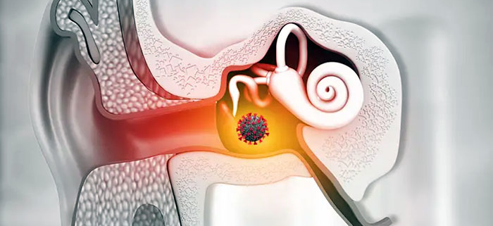 COvid-19 infects inner ear